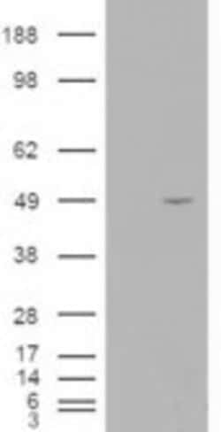 Invitrogen ALS2CR2 Polyclonal Antibody 100 &mu;g; Unconjugated:Antibodies,