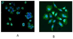 Invitrogen DJ-1 Polyclonal Antibody 100 &mu;g; Unconjugated:Antibodies,