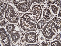 Invitrogen DJ-1 Polyclonal Antibody 100 &mu;g; Unconjugated:Antibodies,