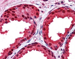 Invitrogen DJ-1 Polyclonal Antibody 100 &mu;g; Unconjugated:Antibodies,