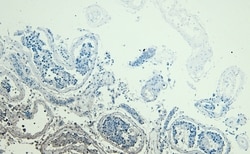 Invitrogen DJ-1 Polyclonal Antibody 100 &mu;g; Unconjugated:Antibodies,