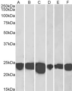 Invitrogen DJ-1 Polyclonal Antibody 100 &mu;g; Unconjugated:Antibodies,