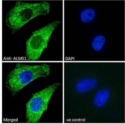 Invitrogen ALMS1 Polyclonal Antibody 100 &mu;g; Unconjugated:Antibodies,