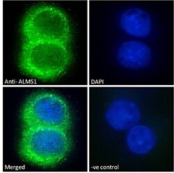 Invitrogen ALMS1 Polyclonal Antibody 100 &mu;g; Unconjugated:Antibodies,