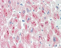 Invitrogen MURF2 Polyclonal Antibody 100 &mu;g | Buy Online | Invitrogen&trade; | Fisher Scientific