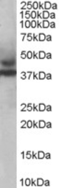 Invitrogen MURF3 Polyclonal Antibody 100 &mu;g; Unconjugated:Antibodies,