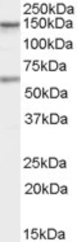 Invitrogen CARD11 Polyclonal Antibody 100 &mu;g; Unconjugated:Antibodies,