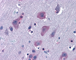 Invitrogen TRIM2 Polyclonal Antibody 100 &mu;g; Unconjugated:Antibodies,