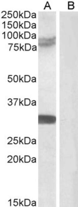 Invitrogen TRIM2 Polyclonal Antibody 100 &mu;g; Unconjugated:Antibodies,