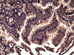 Invitrogen TRIM5 alpha/gamma/delta Polyclonal Antibody 100 &mu;g; Unconjugated:Antibodies,