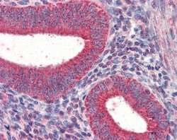 Invitrogen TRIM5 alpha/gamma/delta Polyclonal Antibody 100 &mu;g; Unconjugated:Antibodies,