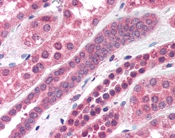Invitrogen Amisyn Polyclonal Antibody 100 &mu;g; Unconjugated:Antibodies,