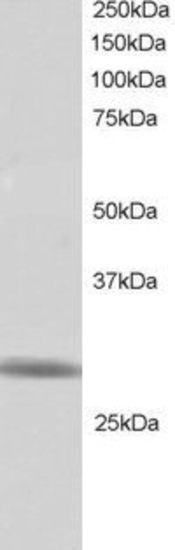 Invitrogen RNF141 Polyclonal Antibody 100 &mu;g; Unconjugated:Antibodies,