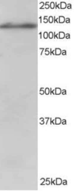 Invitrogen USP11 Polyclonal Antibody 100 &mu;g; Unconjugated:Antibodies,