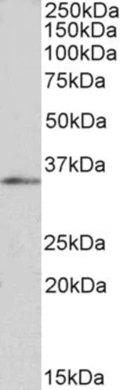 Invitrogen FOXB1 Polyclonal Antibody 100 &mu;g; Unconjugated:Antibodies,