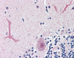 Invitrogen FOXC1 Polyclonal Antibody 100 &mu;g; Unconjugated:Antibodies,
