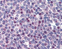 Invitrogen FOXC1 Polyclonal Antibody 100 &mu;g; Unconjugated:Antibodies,