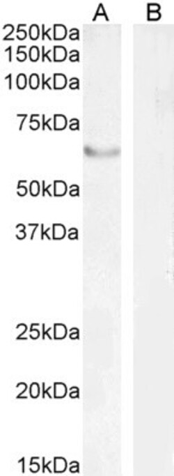 Invitrogen FOXC2 Polyclonal Antibody 100 μg; Unconjugated:Antibodies,