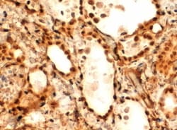 Invitrogen FOXE1 Polyclonal Antibody 100 &mu;g; Unconjugated:Antibodies,