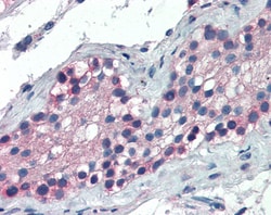 Invitrogen FOXE1 Polyclonal Antibody 100 &mu;g; Unconjugated:Antibodies,
