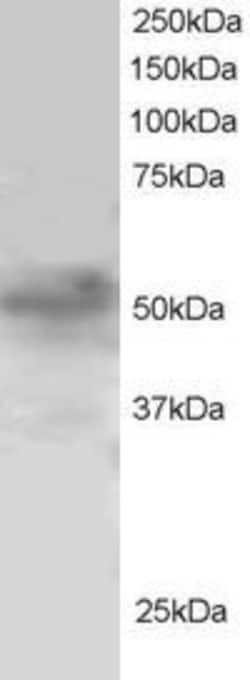 Invitrogen FOXQ1 Polyclonal Antibody 100 &mu;g; Unconjugated:Antibodies,