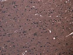 Invitrogen FBXL2 Polyclonal Antibody 100 &mu;g | Buy Online | Invitrogen&trade; | Fisher Scientific