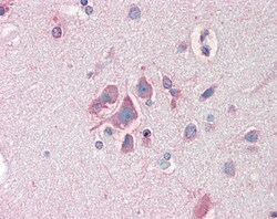 Invitrogen FBXL2 Polyclonal Antibody 100 &mu;g | Buy Online | Invitrogen&trade; | Fisher Scientific