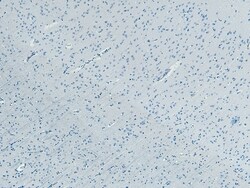 Invitrogen FBXL2 Polyclonal Antibody 100 &mu;g | Buy Online | Invitrogen&trade; | Fisher Scientific