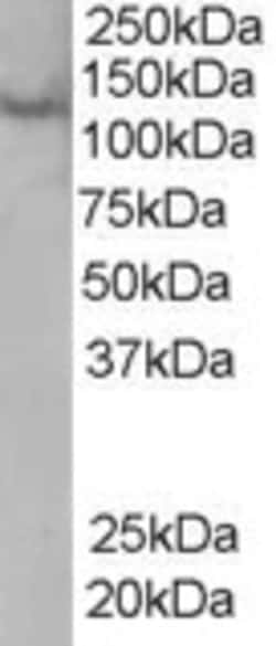 Invitrogen Rabenosyn 5 Polyclonal Antibody 100 μg; Unconjugated:Antibodies,