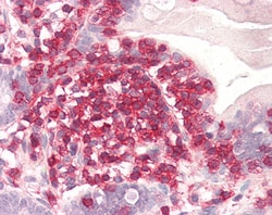 Invitrogen Coronin 1A Polyclonal Antibody 100 &mu;g; Unconjugated:Antibodies,