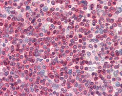 Invitrogen Coronin 1A Polyclonal Antibody 100 &mu;g; Unconjugated:Antibodies,