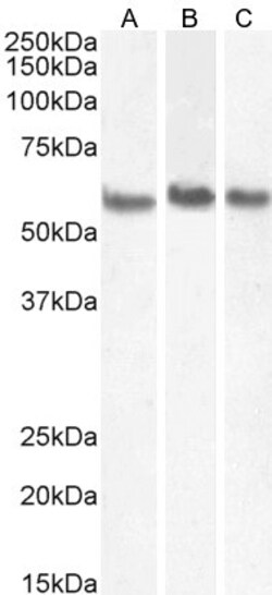Invitrogen Coronin 1A Polyclonal Antibody 100 &mu;g; Unconjugated:Antibodies,