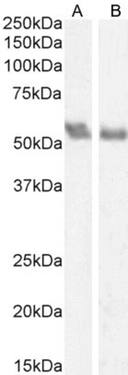 Invitrogen Coronin 1A Polyclonal Antibody 100 &mu;g; Unconjugated:Antibodies,