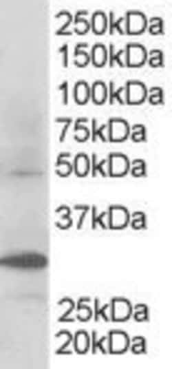 Invitrogen FBXW2 Polyclonal Antibody 100 &mu;g; Unconjugated:Antibodies,