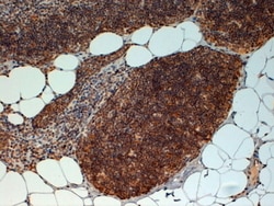 Invitrogen FOXN1 Polyclonal Antibody 100 μg; Unconjugated:Antibodies,