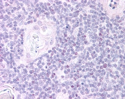 Invitrogen FOXN1 Polyclonal Antibody 100 μg; Unconjugated:Antibodies,