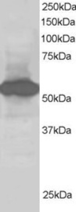 Invitrogen SIL1 Polyclonal Antibody 100 &mu;g | Buy Online | Invitrogen&trade; | Fisher Scientific