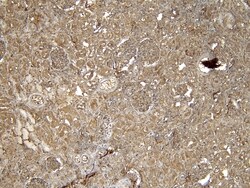 Invitrogen EPS8 Polyclonal Antibody 100 &mu;g; Unconjugated:Anticuerpos