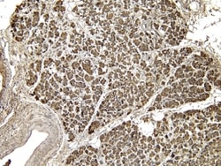 Invitrogen EPS8 Polyclonal Antibody 100 &mu;g; Unconjugated:Anticuerpos