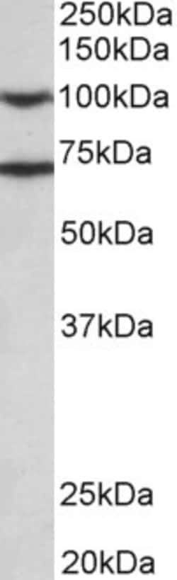 Invitrogen EPS8 Polyclonal Antibody 100 &mu;g; Unconjugated:Anticuerpos