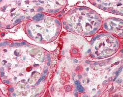 Invitrogen Centaurin alpha-2 Polyclonal Antibody 100 &mu;g; Unconjugated:Antibodies,