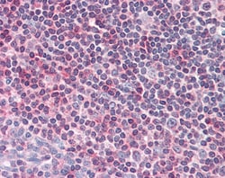 Invitrogen CENTB1 Polyclonal Antibody 100 μg; Unconjugated:Antibodies,
