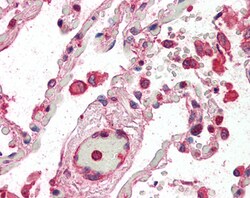 Invitrogen ACAP2 Polyclonal Antibody 100 &mu;g; Unconjugated:Antibodies,