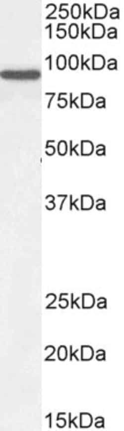 Invitrogen ACAP2 Polyclonal Antibody 100 &mu;g; Unconjugated:Antibodies,