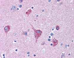 Invitrogen MUNC18 Polyclonal Antibody 100 &mu;g; Unconjugated:Antibodies,
