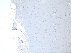Invitrogen MUNC18 Polyclonal Antibody 100 &mu;g; Unconjugated:Antibodies,