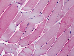 Invitrogen ORP1 Polyclonal Antibody 100 &mu;g; Unconjugated:Antibodies,