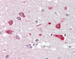 Invitrogen ORP9 Polyclonal Antibody 100 &mu;g; Unconjugated:Antibodies,
