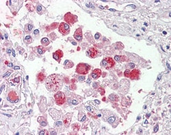 Invitrogen ORP9 Polyclonal Antibody 100 &mu;g; Unconjugated:Antibodies,