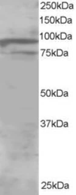 Invitrogen OSBPL11 Polyclonal Antibody 100 &mu;g; Unconjugated:Antibodies,